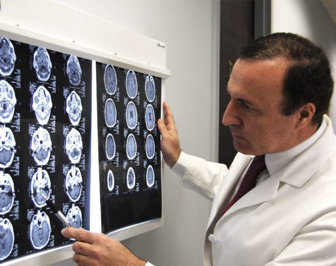 doctor looking at brain scans